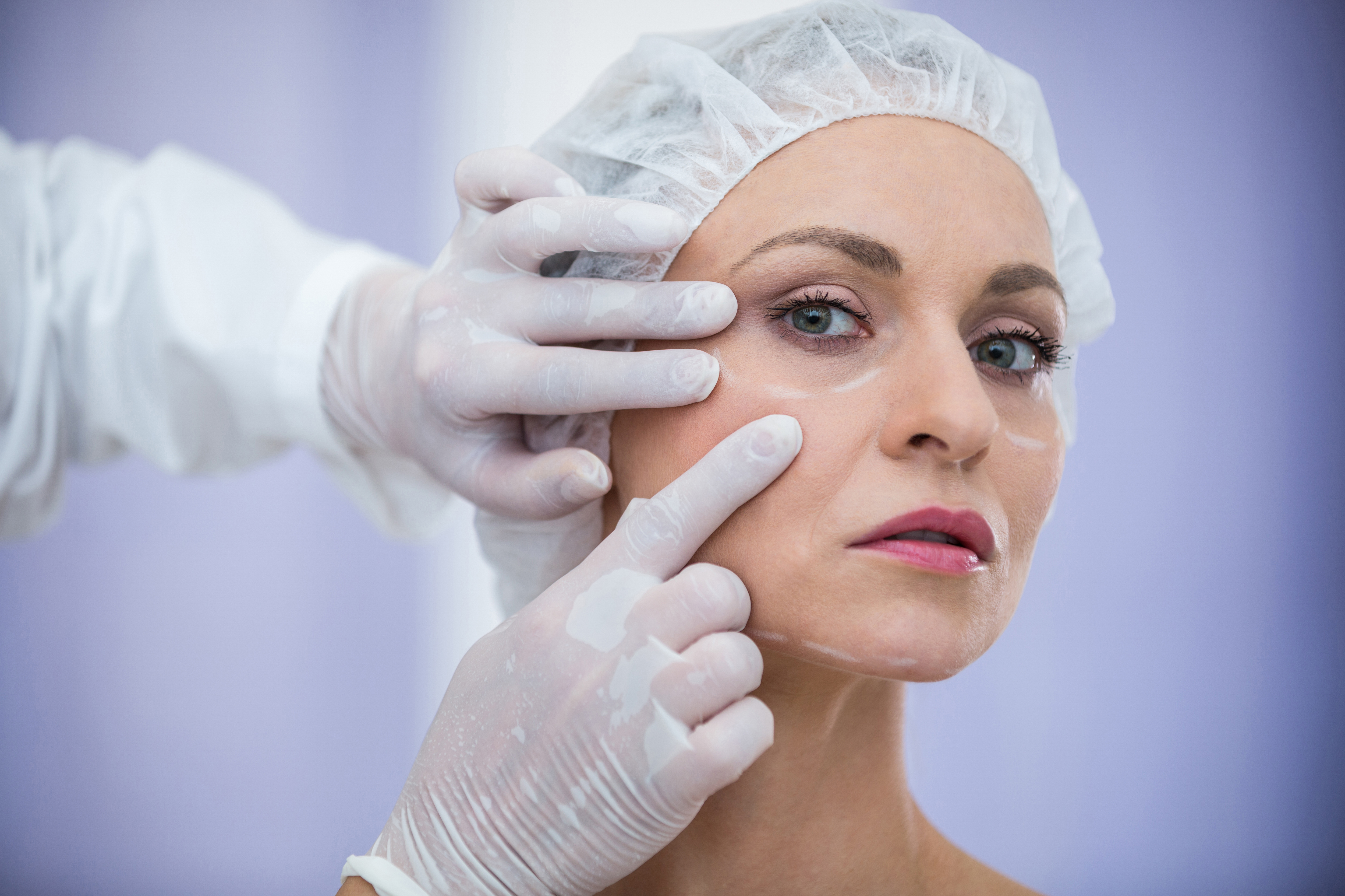 Dermal Fillers